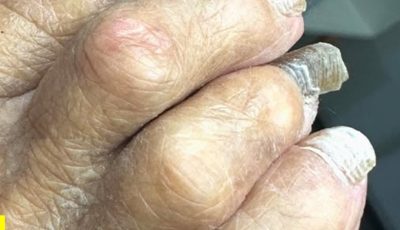 Si tus abuelitos tienen las uñas de los pies así es mejor que… Ver más