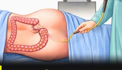 Si tu medico te ordena hacerte la colonoscopia simplemente dile que.