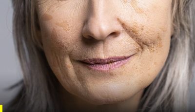 La deficiencia de este mineral puede ser un factor oculto en la aparición de las manchas de la edad 🤯